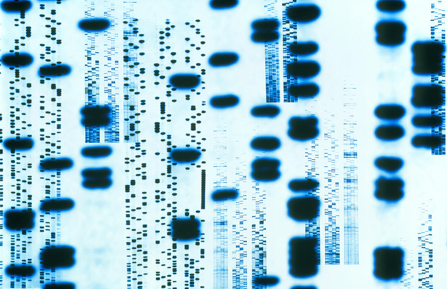 Artwork Of An Autoradiogram Showing Dna Sequences #1 Photograph by Pasieka