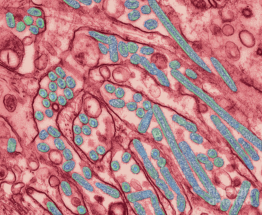 Avian Influenza Photograph by Science Source - Pixels