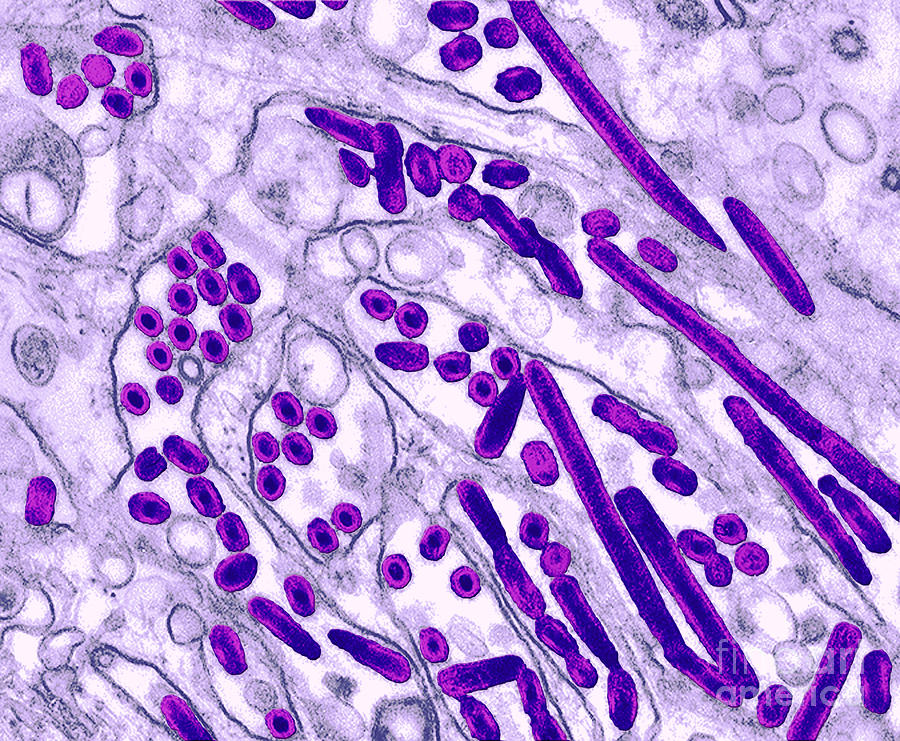 Avian Influenza, Tem #1 Photograph by Science Source