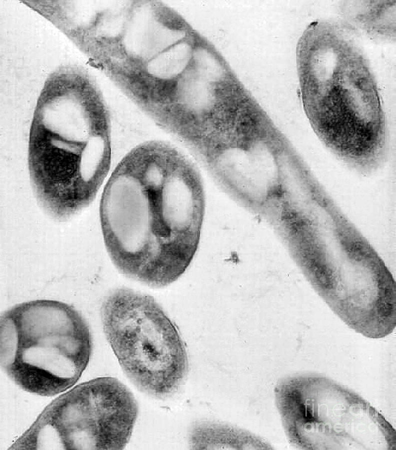 Bacillus Anthracis, Tem #1 Photograph by Science Source