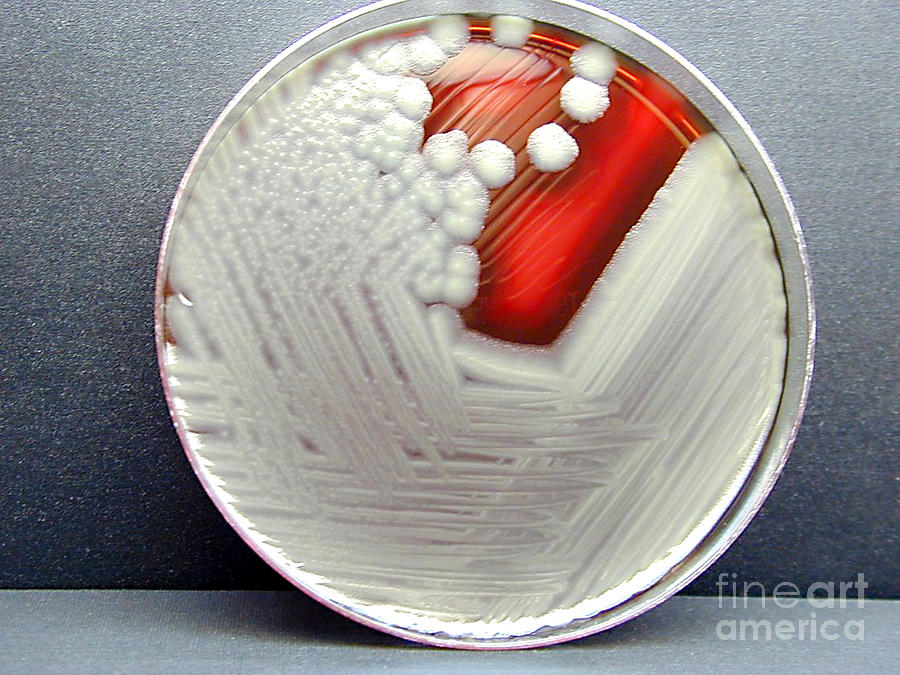 Bacillus Cereus Culture #1 Photograph by Science Source