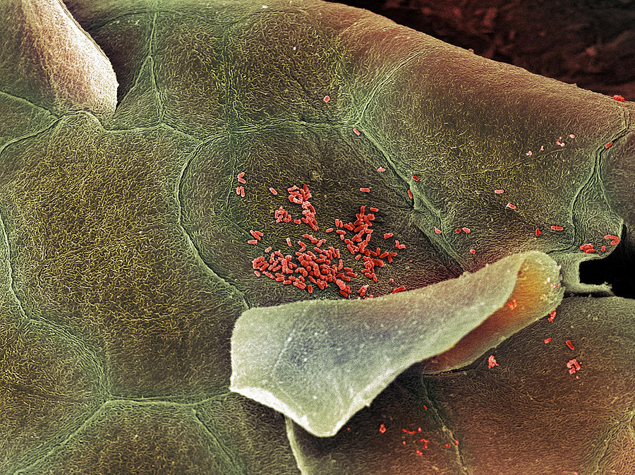 Bacteria Photograph - Bacteria In The Nose, Sem #1 by Steve Gschmeissner