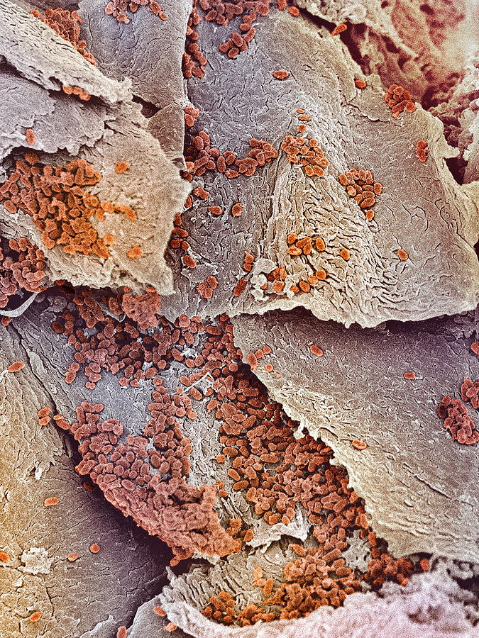 Microscopic Fungi Epidermophyton Floccosum, Scientific Illustration Stock  Illustration - Illustration of microscopic, corporis: 237062339