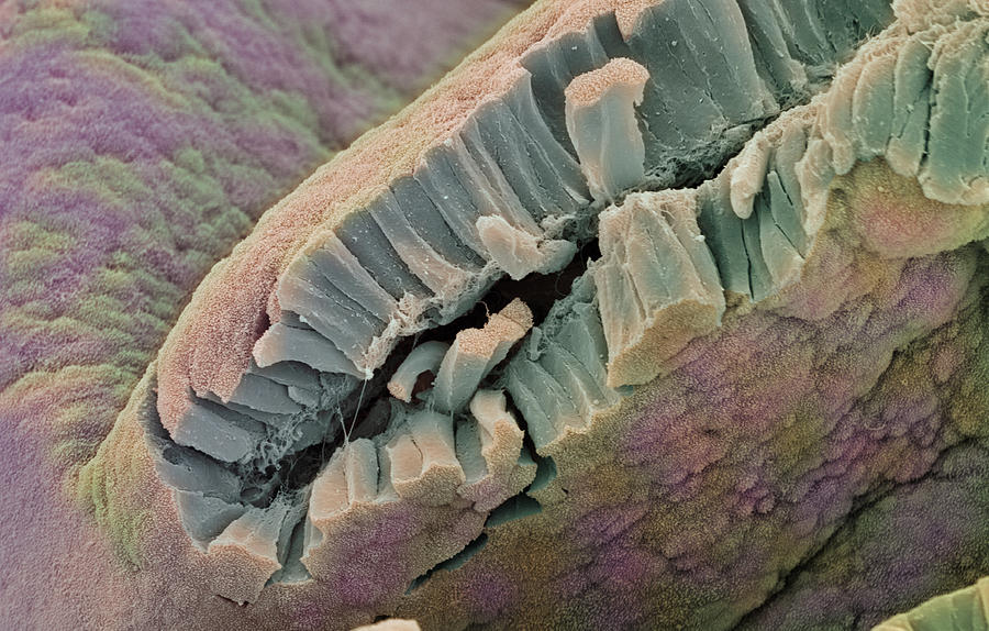 Epithelium Photograph - Bladder Lining #1 by Steve Gschmeissner