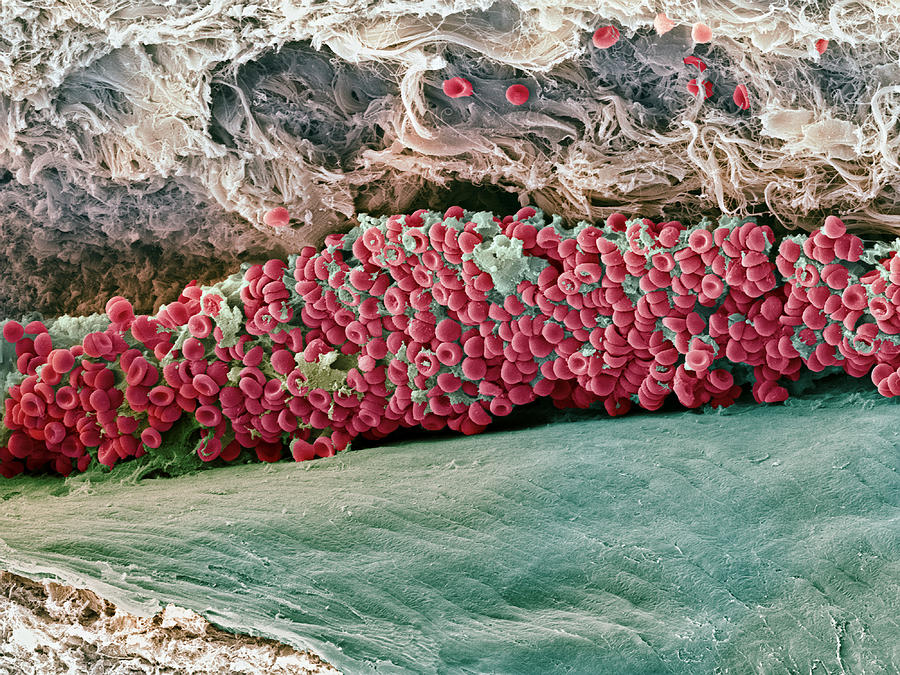 Red Blood Cell Photograph - Blood Clot, Sem #1 by Steve Gschmeissner