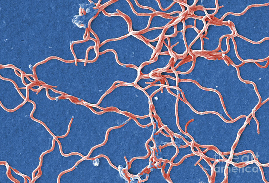 Borrelia Burgdorferi Bacteria, Sem #1 Photograph by Science Source