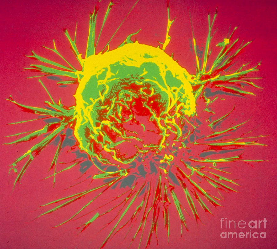 Breast Cancer Cell #1 Photograph by Science Source