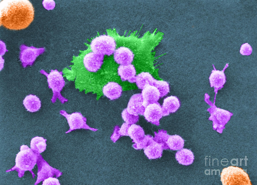 Scanning Electron Micrograph Photograph - Cancer Cell Death, Sem 2 Of 6 #1 by Science Source