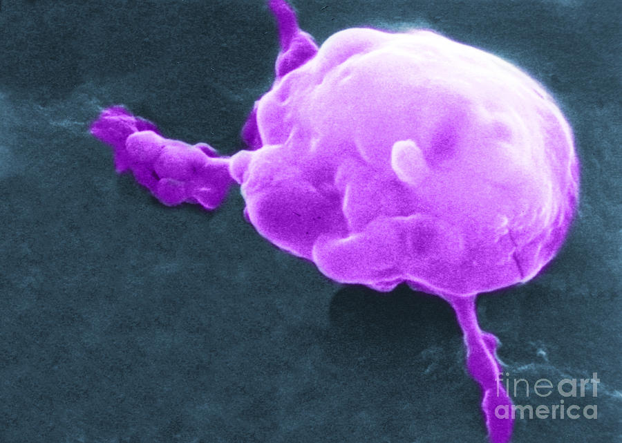 Scanning Electron Micrograph Photograph - Cancer Cell Death, Sem 5 Of 6 #1 by Science Source