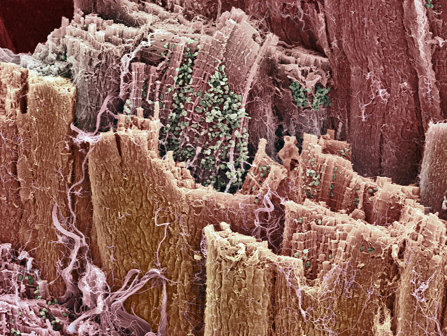 Cardiac Muscle, Sem Photograph by Steve Gschmeissner - Fine Art America