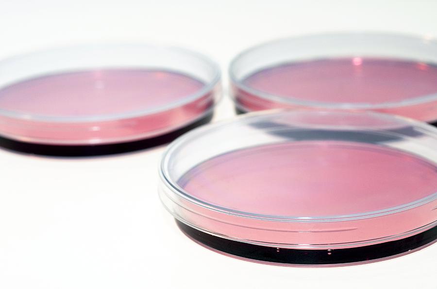 Cell Cultures In Petri Dishes Photograph by Photostock-israel - Fine ...