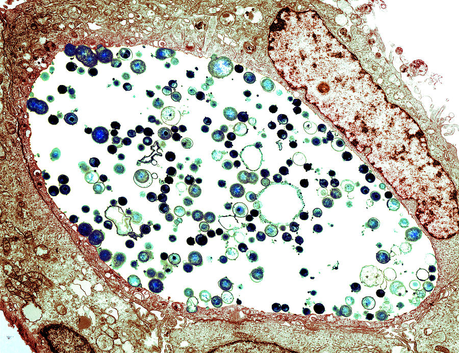 Chlamydia Trachomatis Photograph - Chlamydia Trachomatis Bacteria, Tem #1 by Biomedical Imaging Unit, Southampton General Hospital