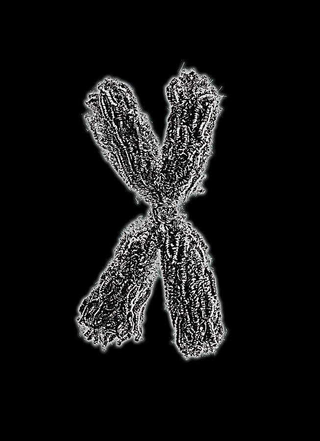 Chromosome Photograph - Chromosome #1 by Tim Vernon, Lth Nhs Trust