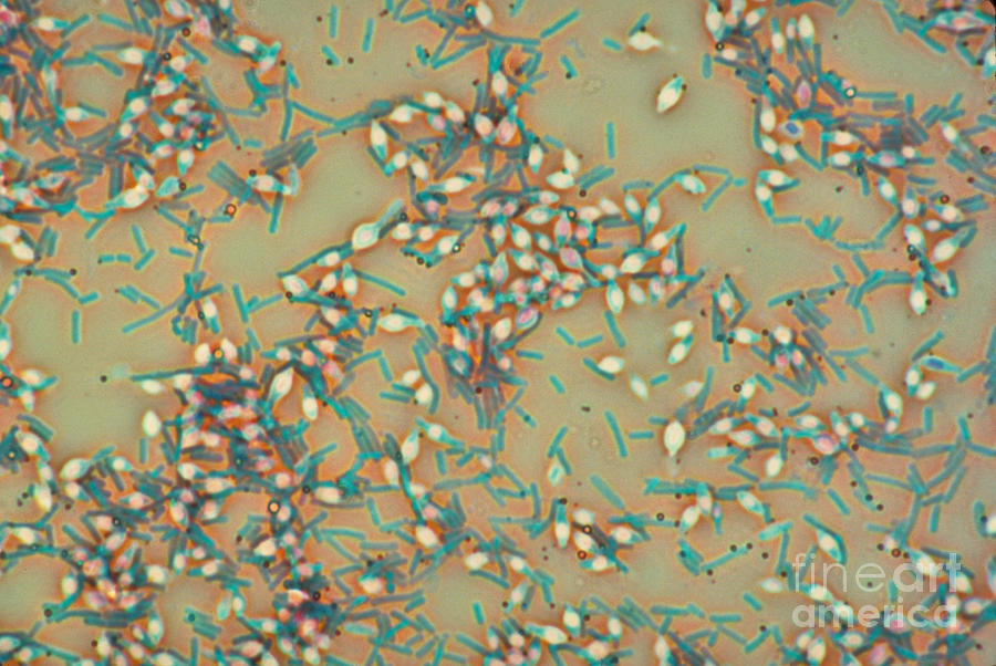 Clostridium Botulinum #1 Photograph by M. I. Walker