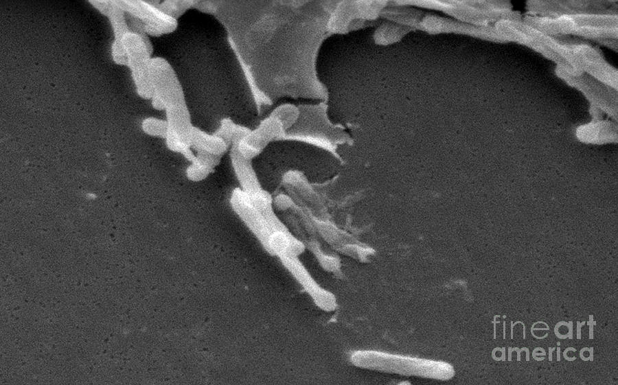 Clostridium Difficile Bacteria, Sem #1 Photograph by Science Source