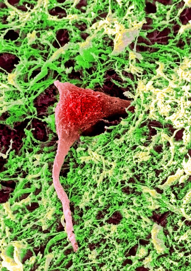 Nerve Cell Photograph - Coloured Sem Of A Nerve Cell In Brain Tissue #1 by Steve Gschmeissner