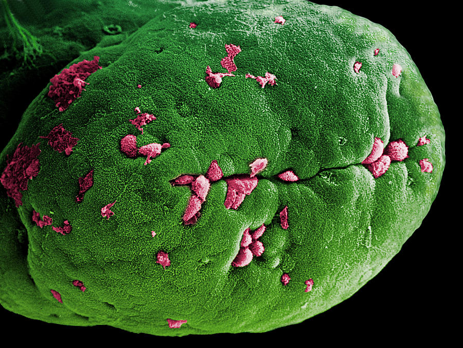 Small Intestine Photograph - Coloured Sem Of A Villus Of The Small Intestine #1 by Steve Gschmeissner
