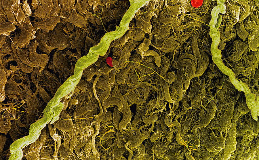 Connective Tissue Photograph - Coloured Sem Of Collagen Connective Tissue Fibres #1 by Steve Gschmeissner