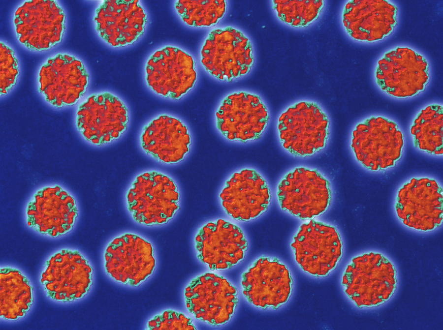 Coloured Tem Of Hepatitis B Virus Particles Photograph By Pasieka ...