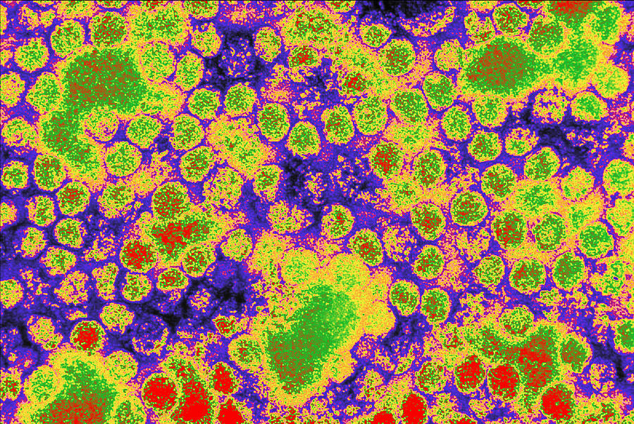 Coloured Tem Of Yellow Fever Viruses Photograph by Cdc - Pixels