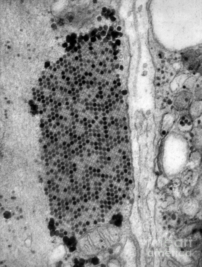 Coxsackie B3 Virus, Tem #1 Photograph by Science Source