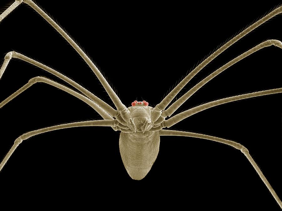 A Small Spiders Leg 100x-250x : r/microscopy