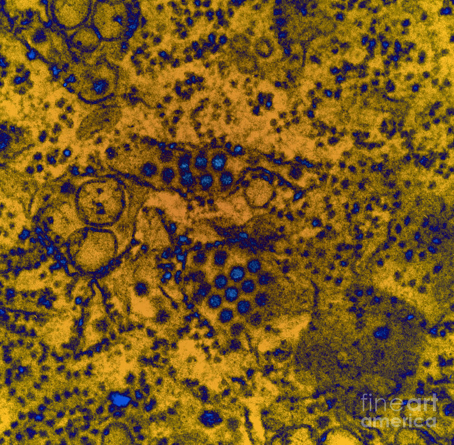 Dengue Virus, Tem #1 Photograph by Science Source