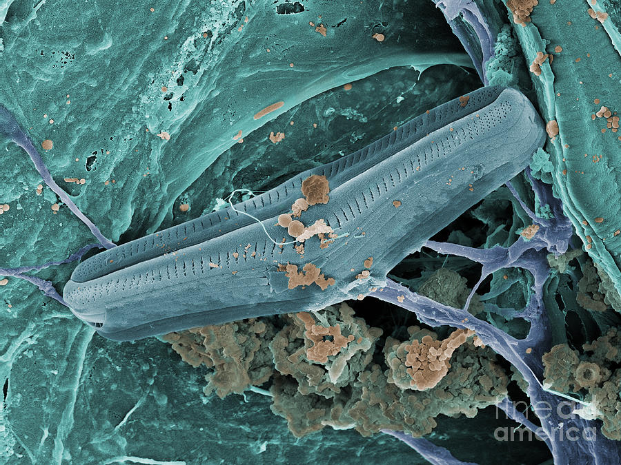 Diatom With Thermophilic Bacteria #1  by Ted Kinsman