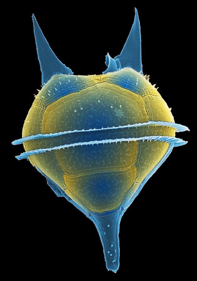 Dinoflagellates Under Microscope