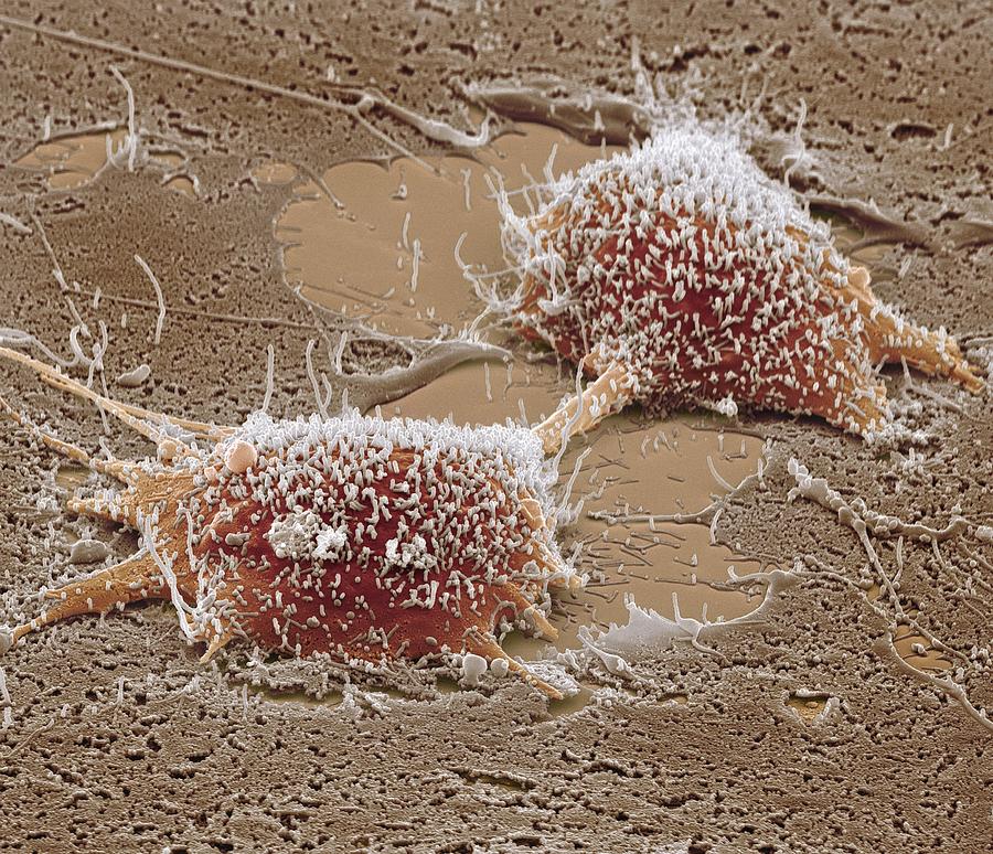 Dividing Cancer Cell Sem Photograph By Steve Gschmeissner Fine Art America 7438