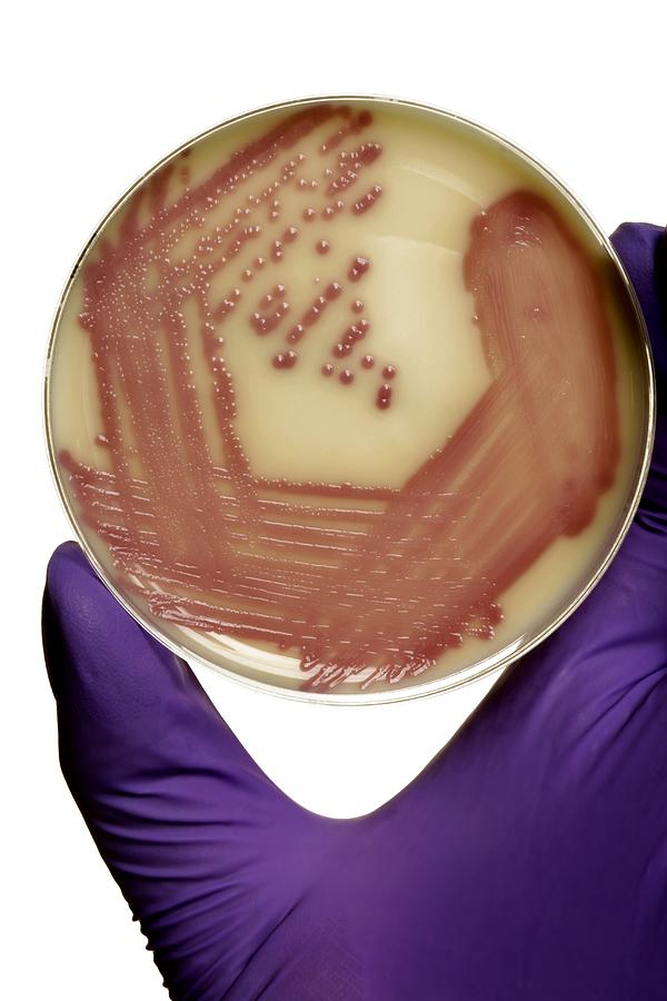 E. Coli Bacteria In A Petri Dish Photograph by Doncaster And Bassetlaw ...