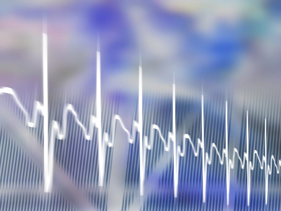 Ecg, Computer Artwork #1 by Alfred Pasieka / Science Photo Library