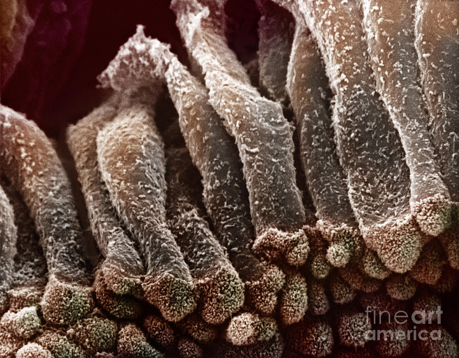 Epithelium Of The Gall Bladder #1 Photograph by Science Source