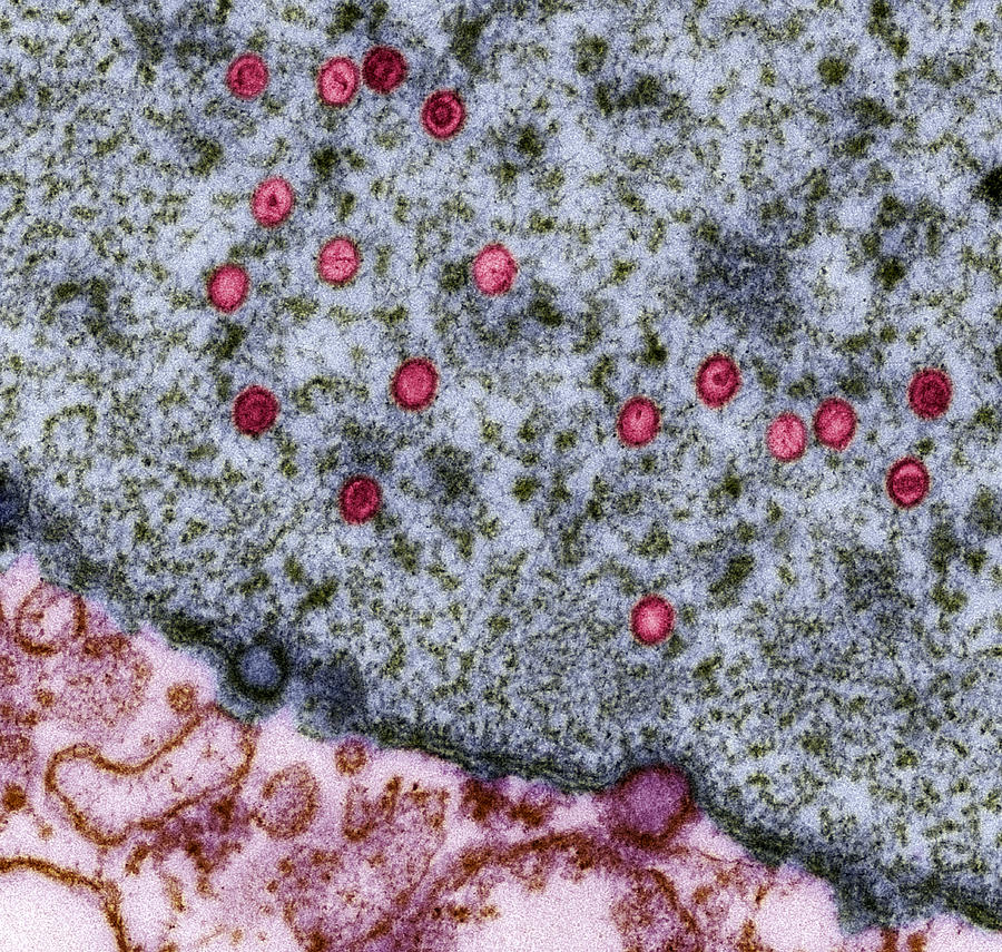 Epstein-barr Virus Particles, Tem #1 Photograph by Steve Gschmeissner