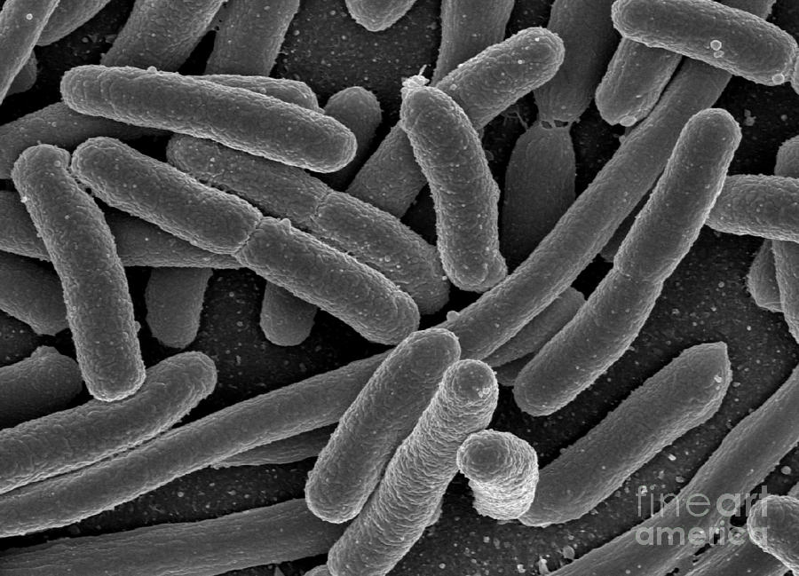 Escherichia Coli Bacteria, Sem #1 Photograph by Science Source