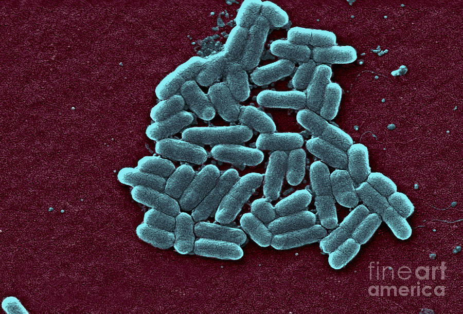 Escherichia Coli O157h7 Bacteria, Sem #1 Photograph by Science Source