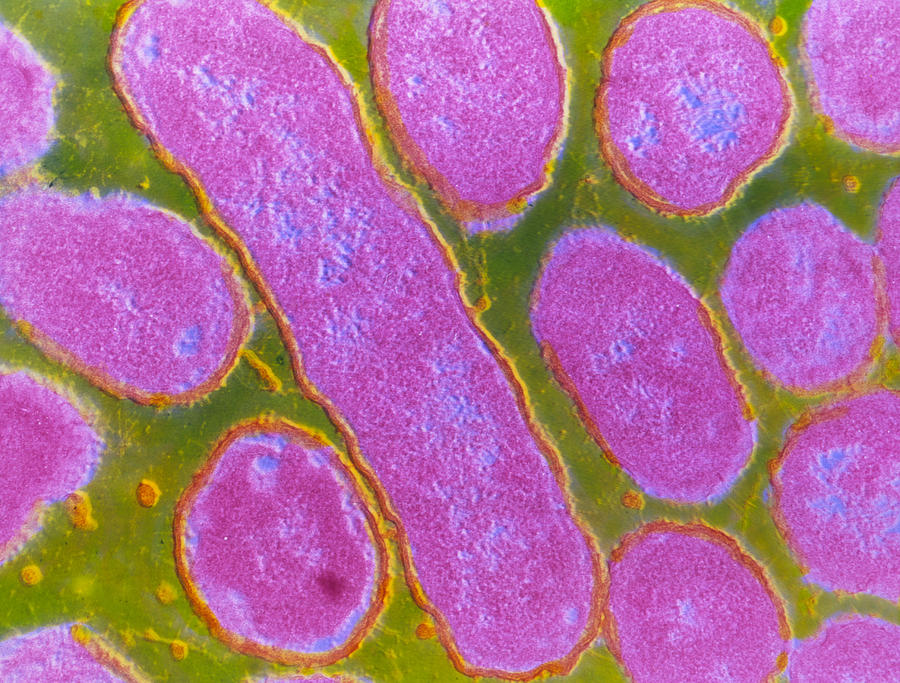 F/col Tem Of Haemophilus Influenzae Photograph By Cnri - Pixels