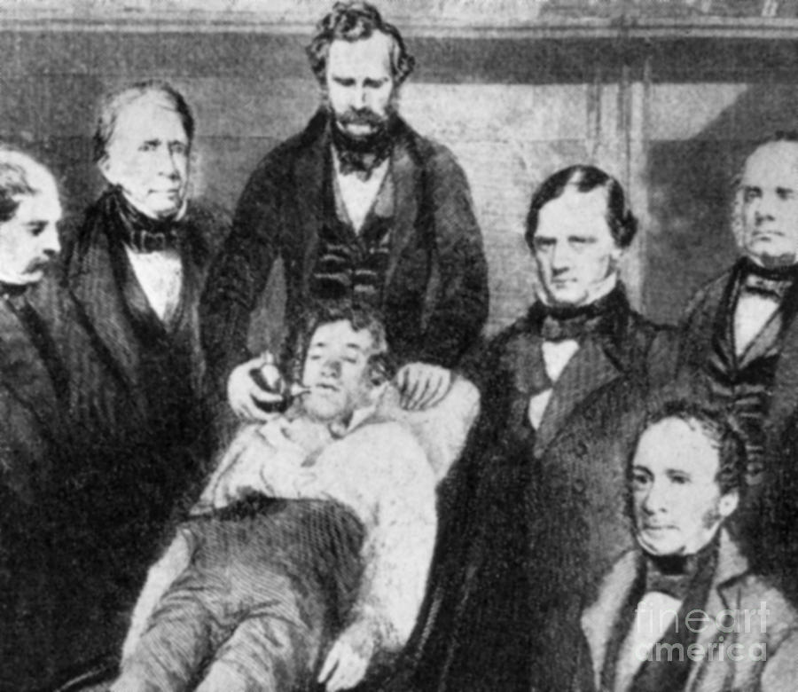 First Use Of Surgical Anesthesia, 1846 #1 Photograph by Science Source