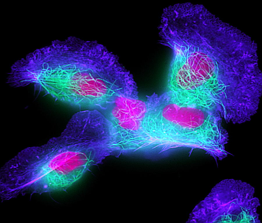 Fish Skin Cells Photograph by Dr Torsten Wittmann