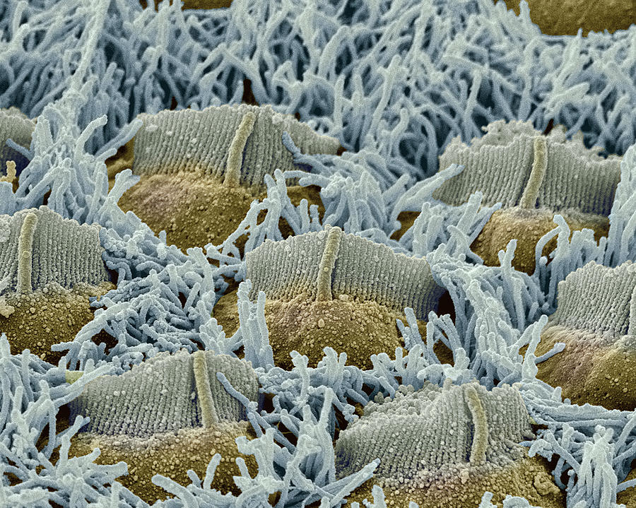 Foetal Inner Ear Hair Cells, Sem #1 Photograph by Steve Gschmeissner