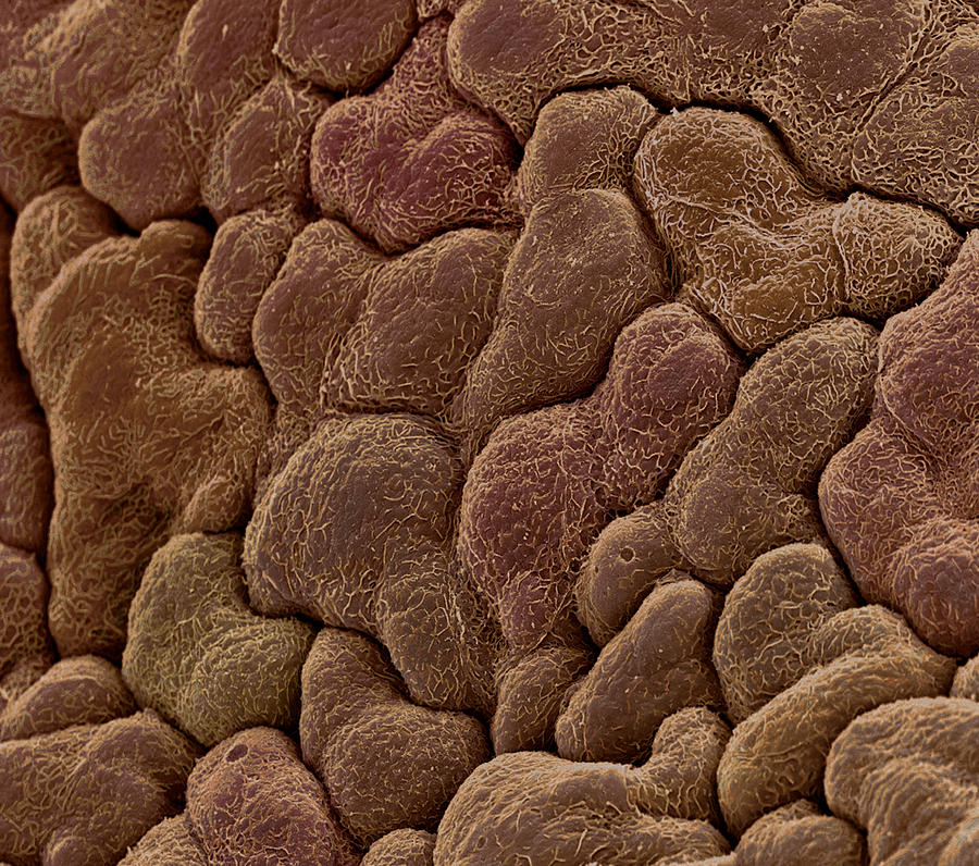 Foetal Skin, Sem Photograph by Steve Gschmeissner - Fine Art America