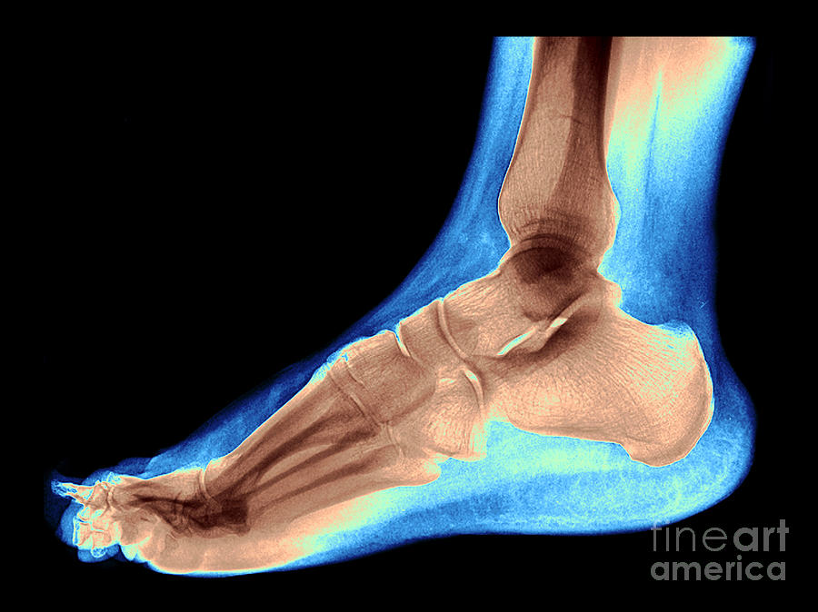 Foot #1 Photograph by Medical Body Scans