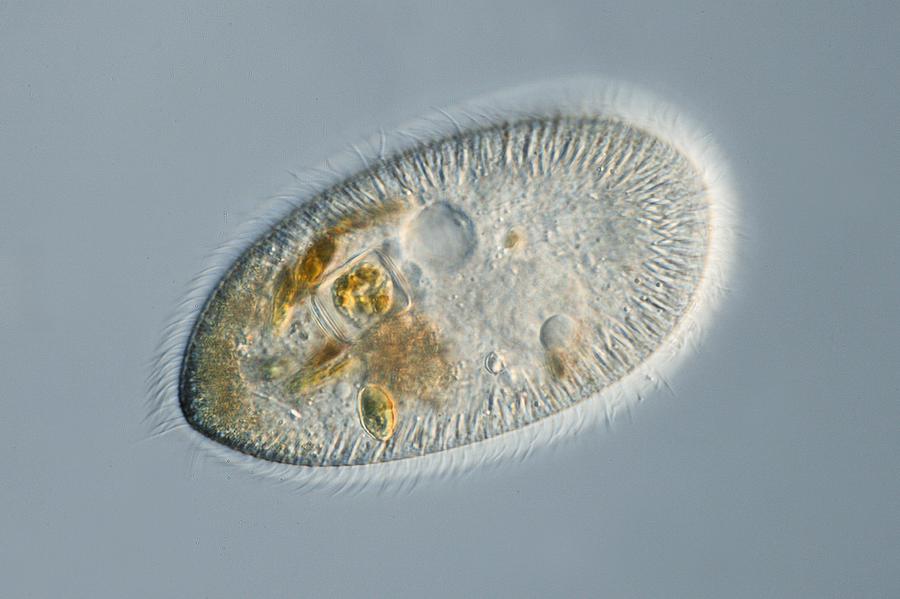 Animal Photograph - Frontonia Protozoan, Light Micrograph #1 by Frank Fox