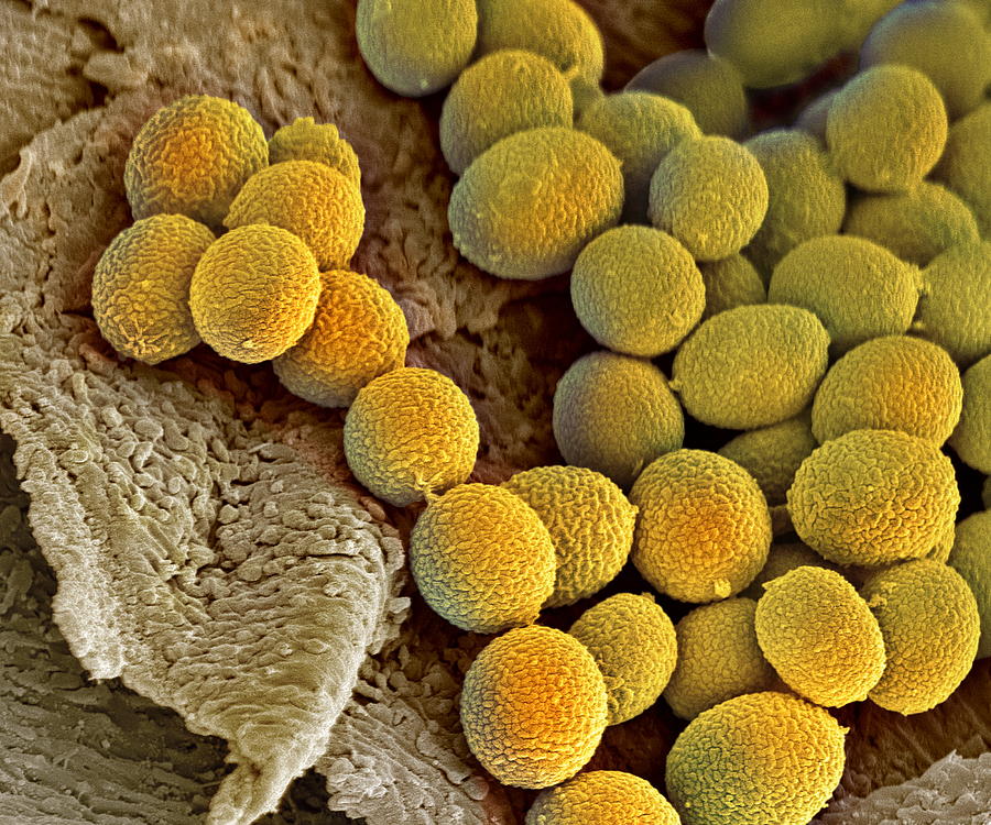Nature Photograph - Fungal Spores, Sem #1 by Steve Gschmeissner
