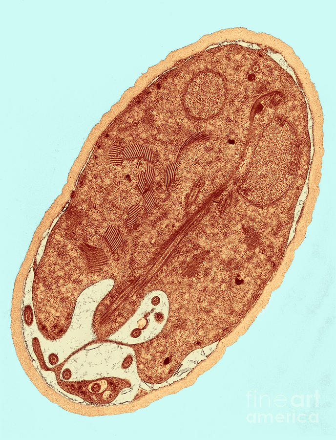Science Photograph - Giardia Sp. Protozoan Tem #1 by Science Source