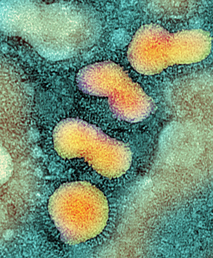 H5n1 Avian Influenza Virus Particles, Tem Photograph By Nibsc - Fine ...