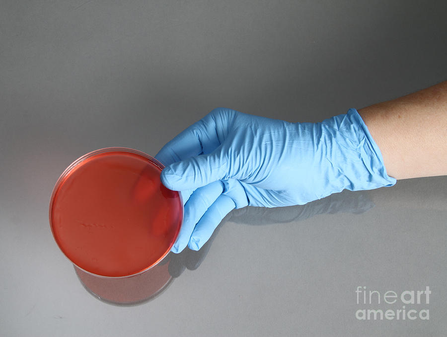 Hand Holding Petri Dish #1 Photograph by Photo Researchers