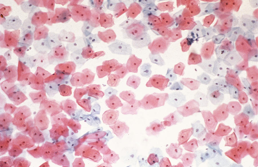 Images Photograph - Healthy Cervical Smear #1 by 