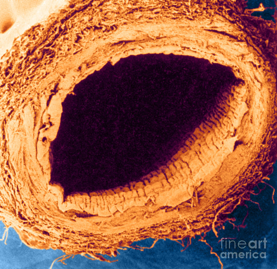 Healthy Vein, Sem #1 Photograph by Science Source