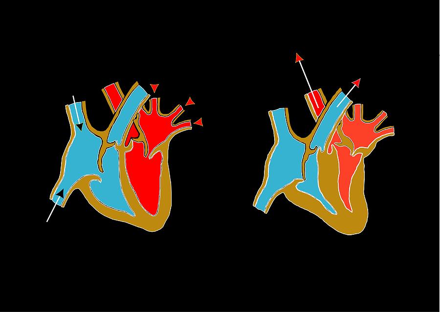 Heart Anatomy Artwork Photograph By Francis Leroy Biocosmos Fine Art America 5116